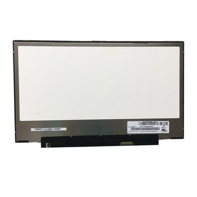 O quadrado Tft do LG Display 141PPI 220cd/M2 indica 15.6in LP156WF9-SPM3